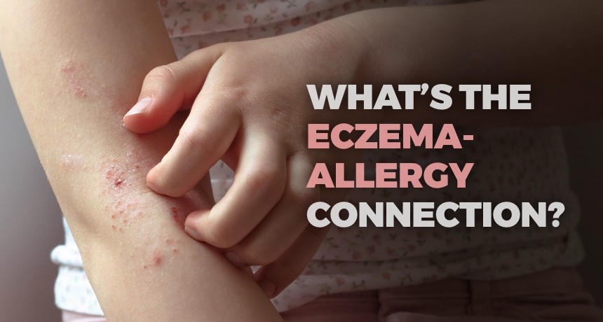 What’s the Eczema-Allergy Connection
